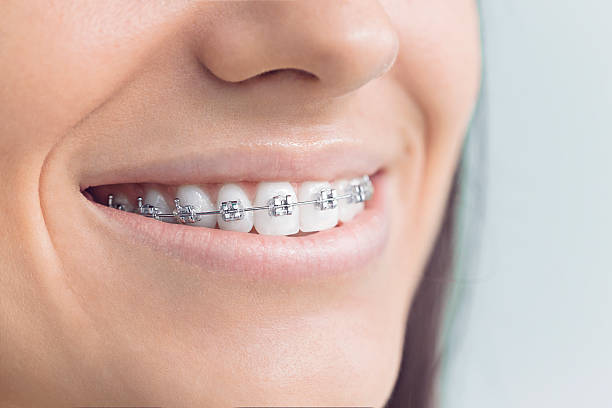 Best Invisalign and Clear Aligners  in Blennerhassett, WV